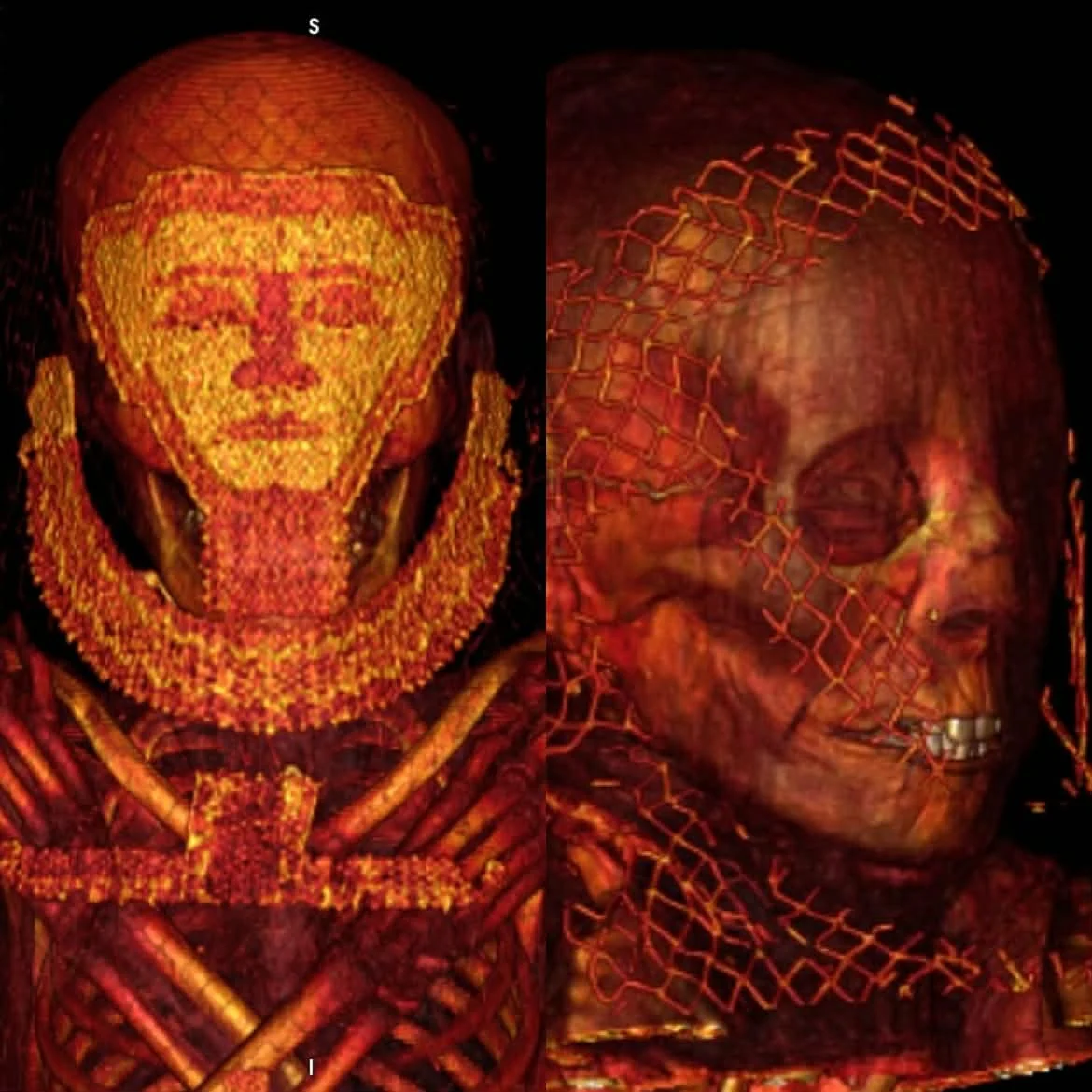 oldest evidence of cancer