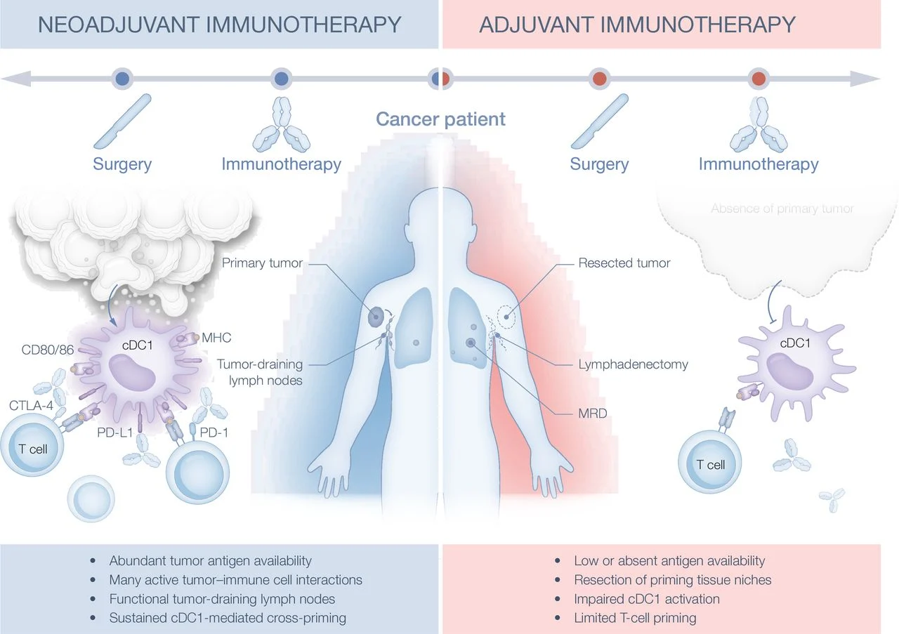 melanoma