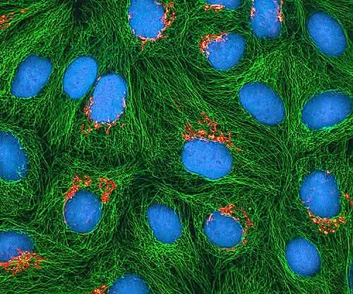 HeLa Cells and Henrietta Lacks
