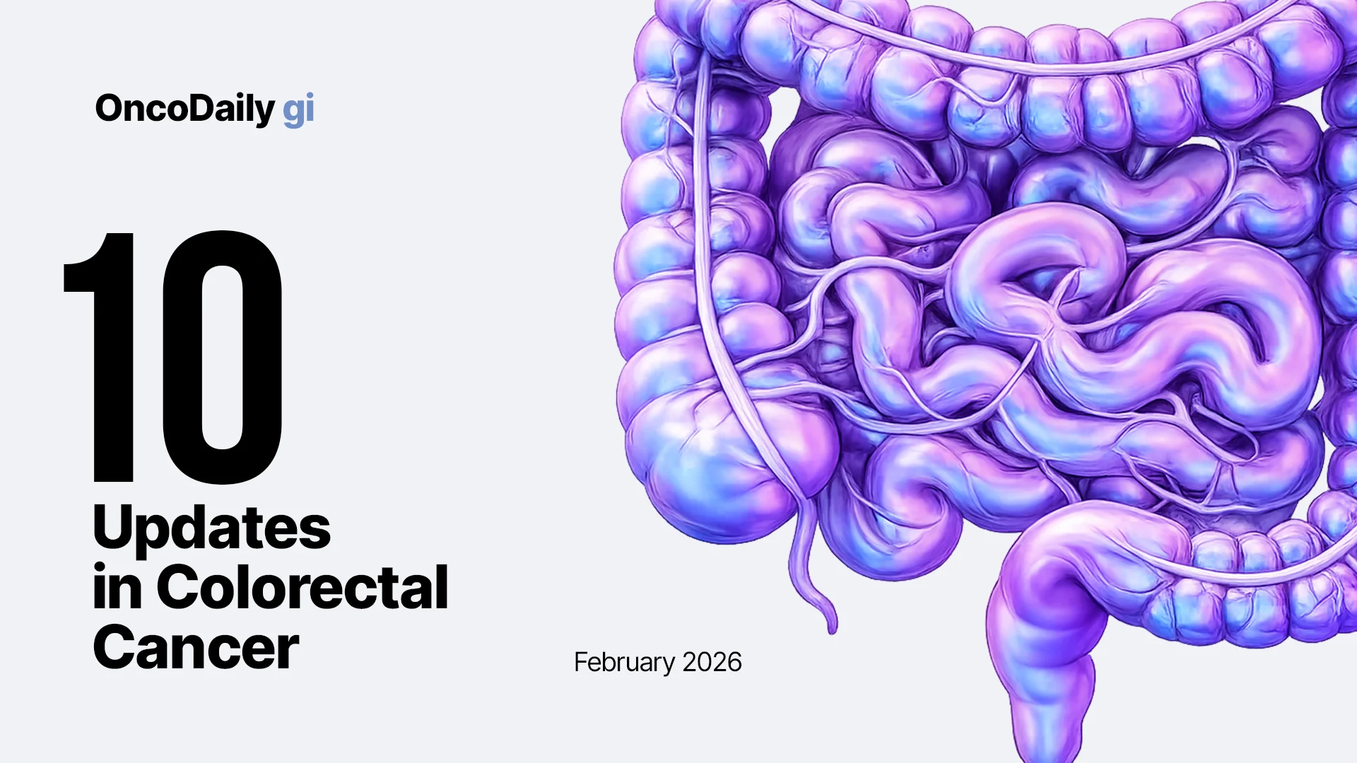 Updates colorectal cancer