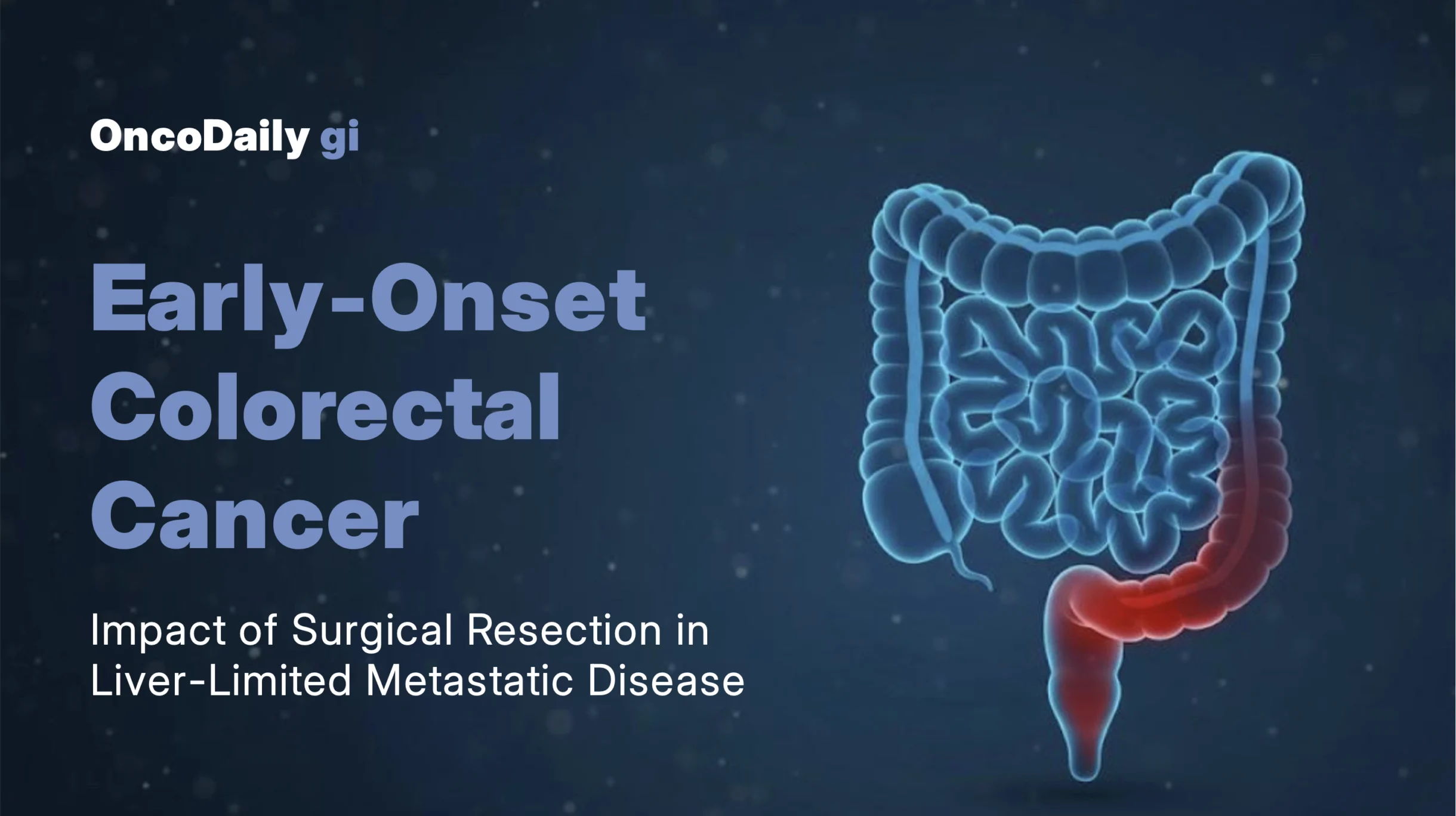colorectal cancer