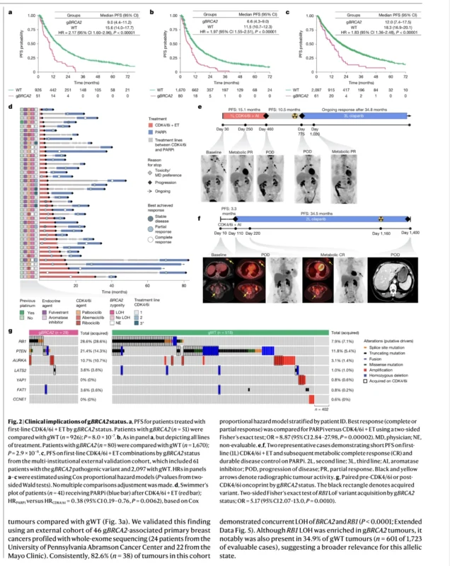 BRCA2-Driven Breast Cancer