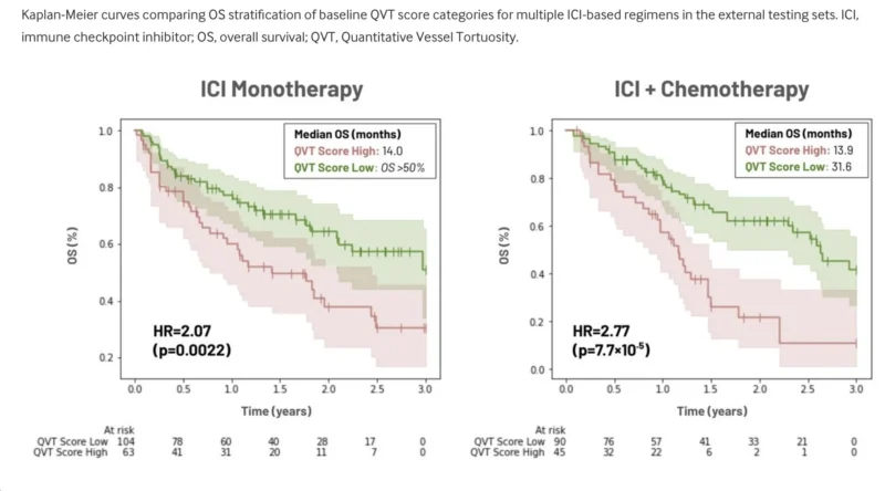 QVT Score In NSCLC Immunotherapy