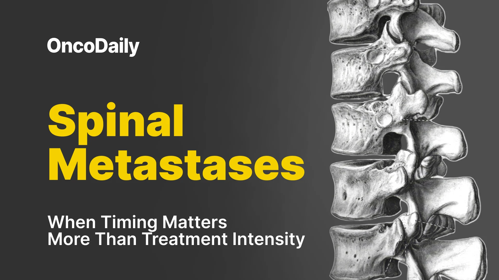 Spinal Metastases