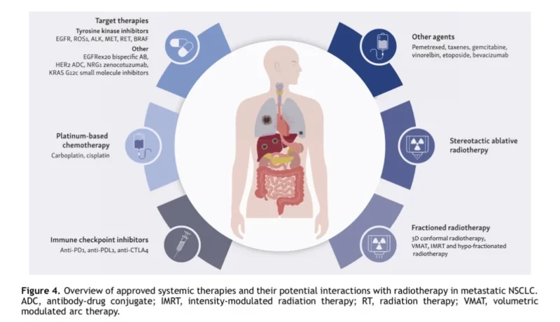 Definitive Radiotherapy
