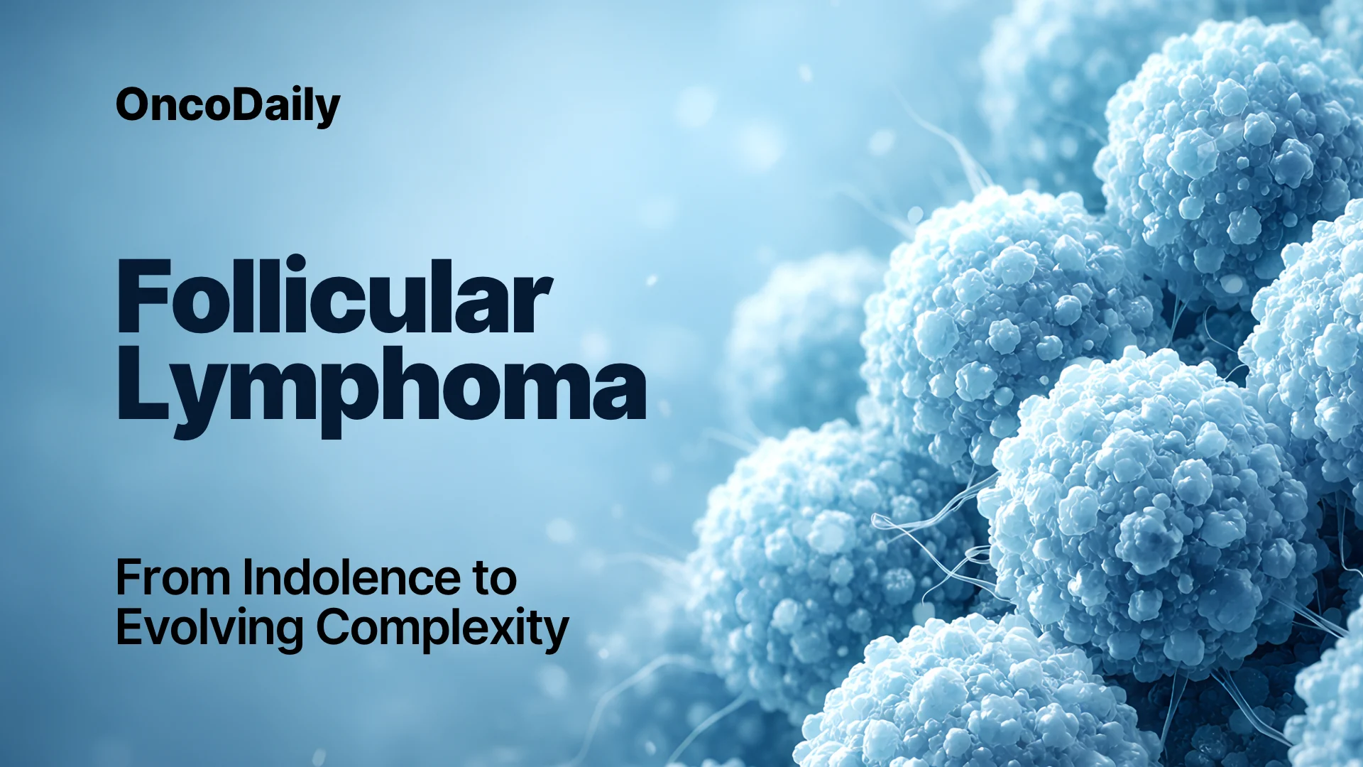 Follicular lymphoma (FL)