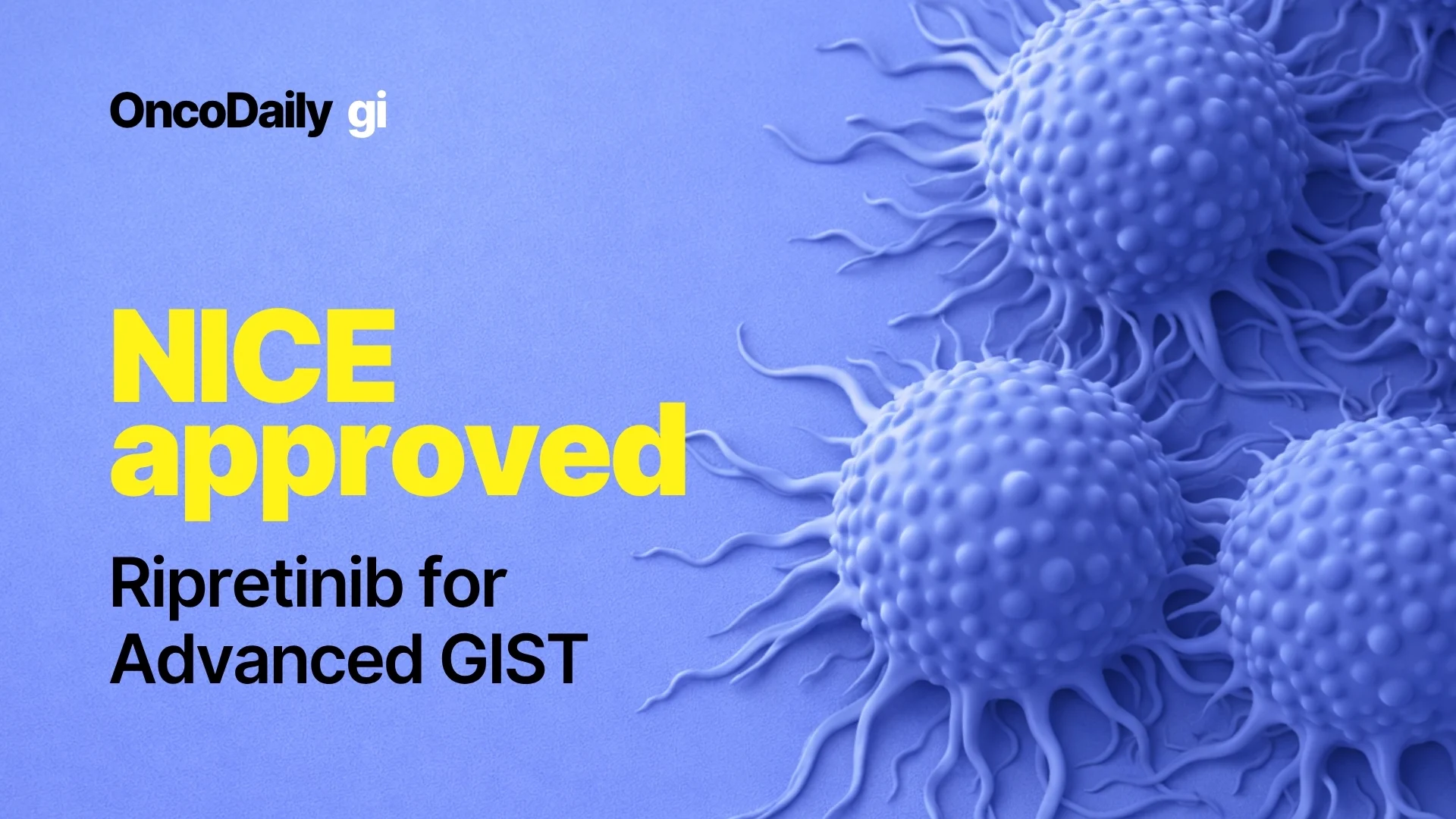 Ripretinib approval for GIST