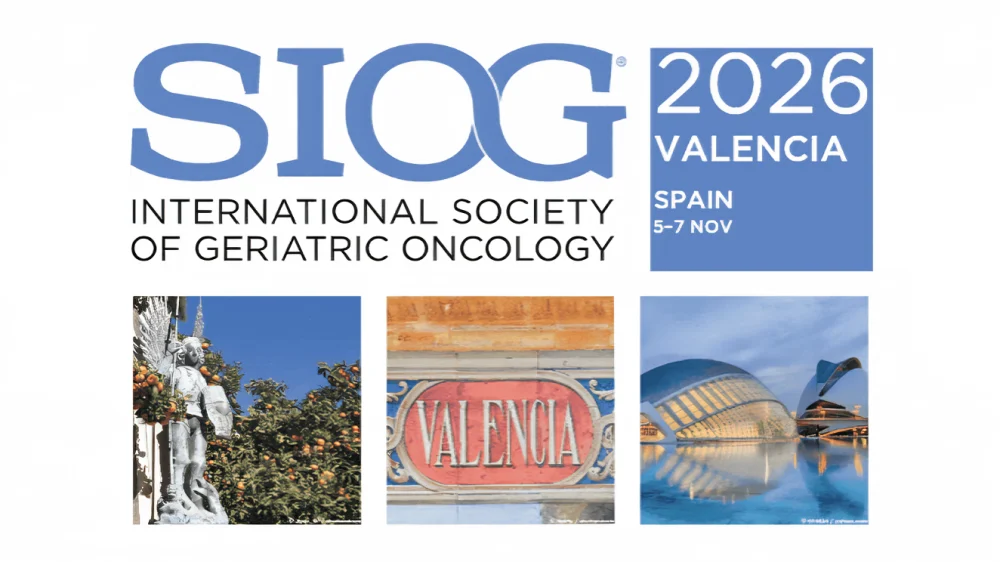 SIOG