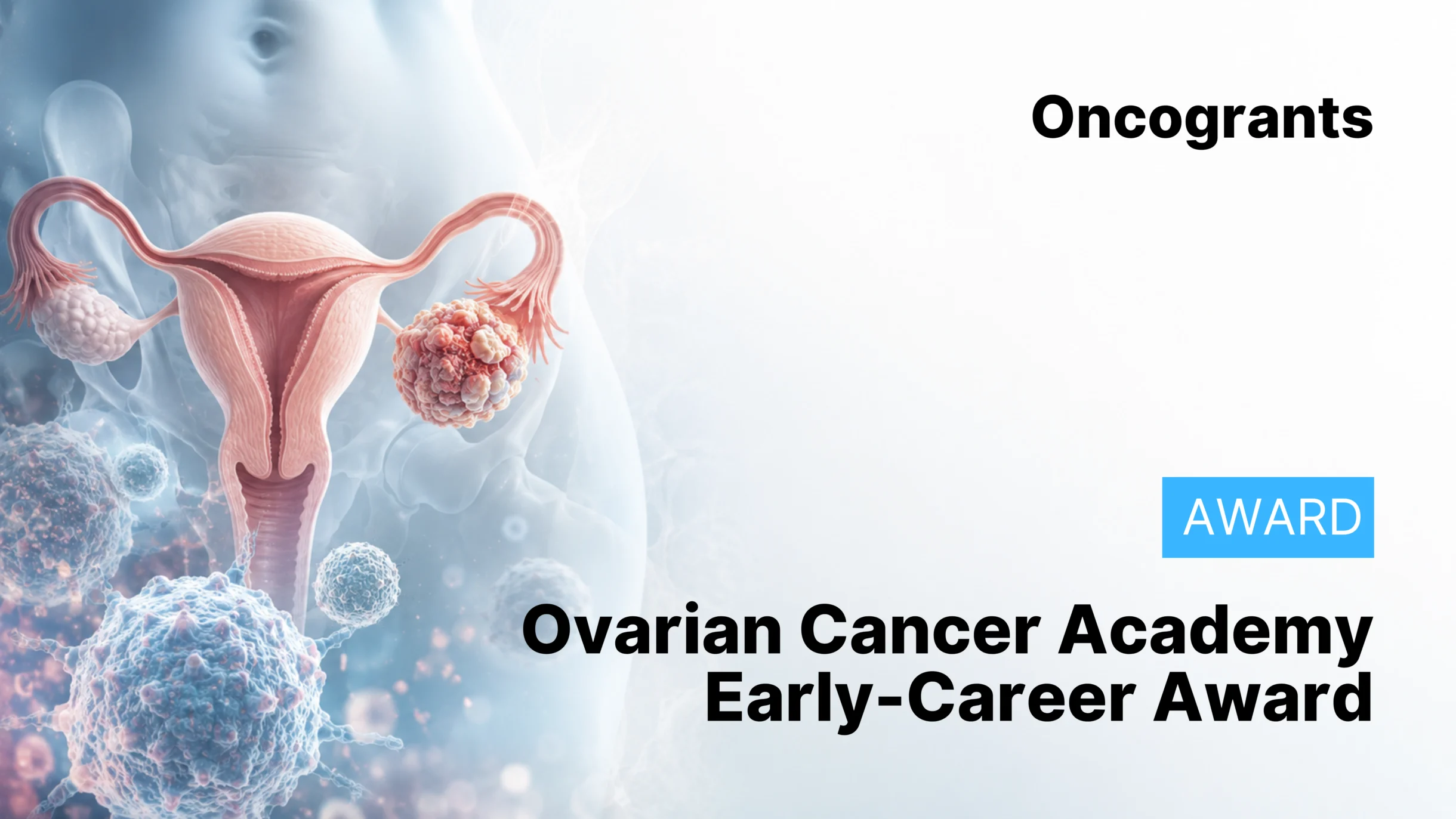 Ovarian Cancer Academy – Early-Career Investigator Award — DoD OCRP