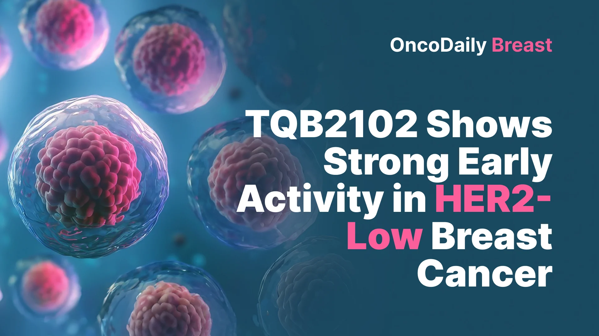 TQB2102