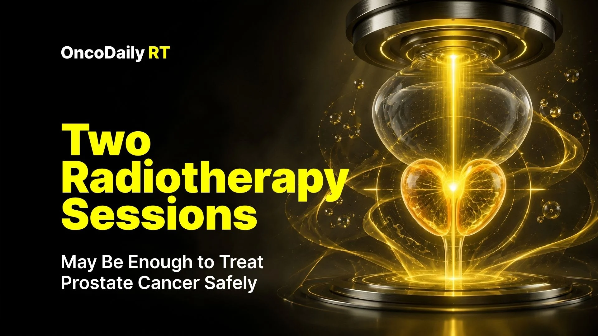 radiotherapy -OncoDaily