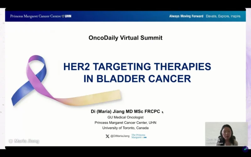 bladder cancer - OncoDaily