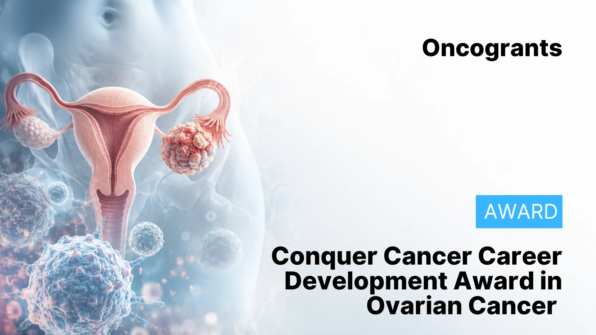 Award in Ovarian Cancer