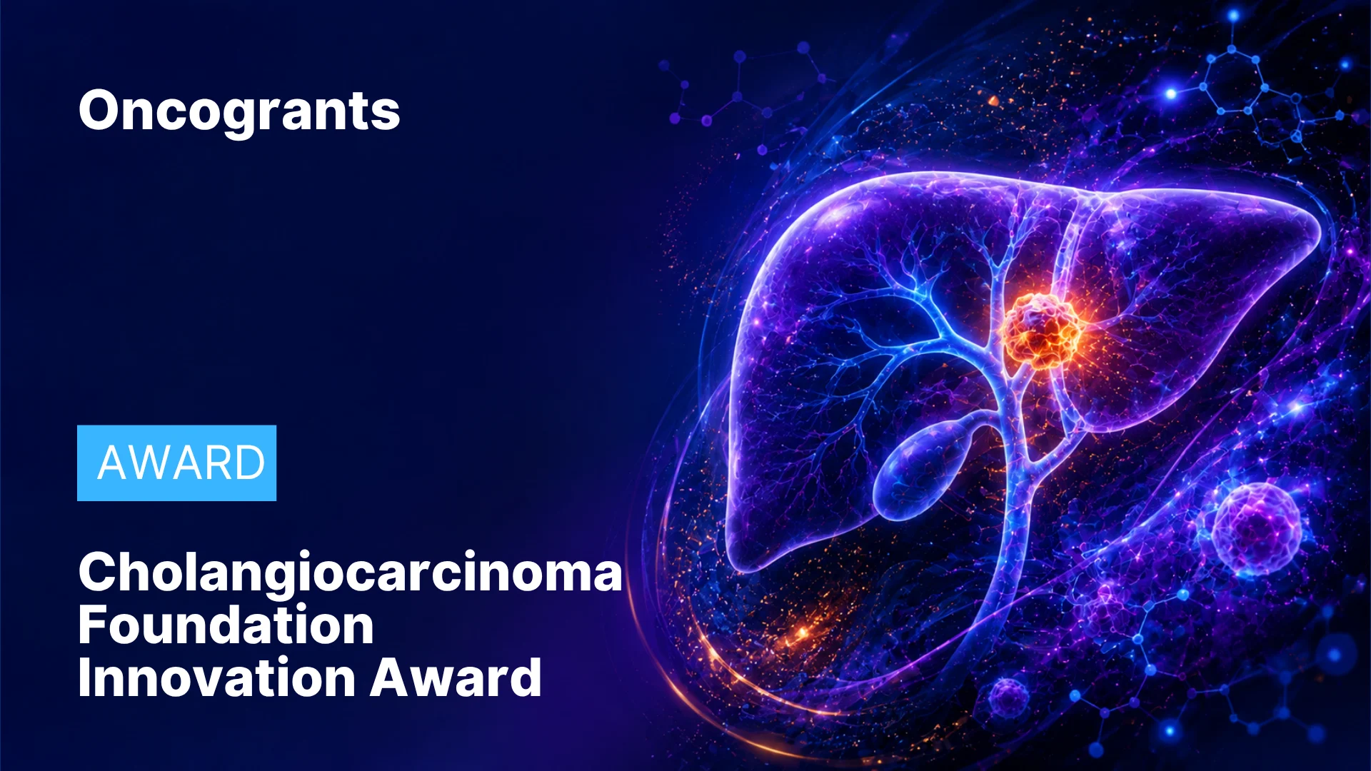 Cholangiocarcinoma