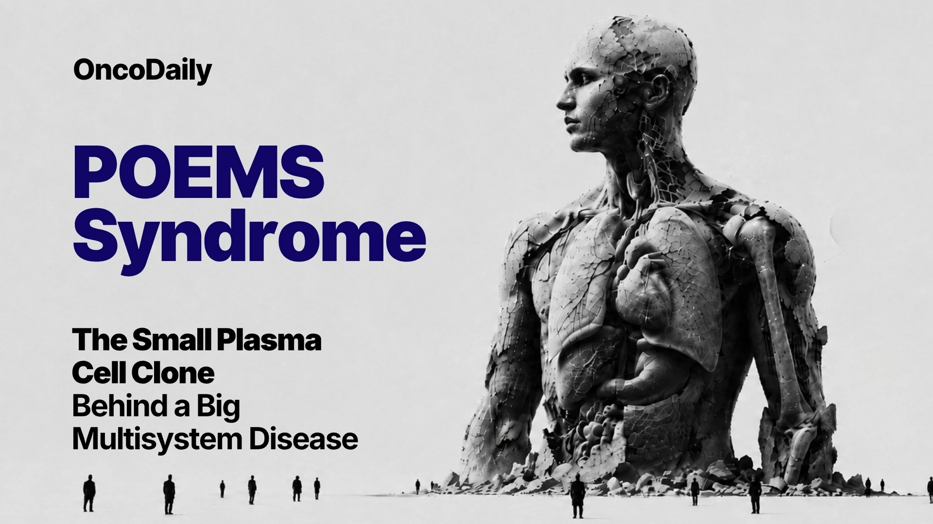 POEMS Syndrome