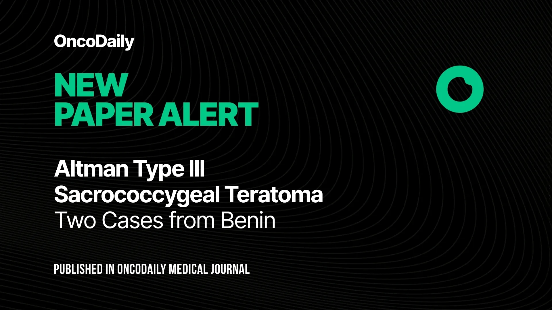 Sacrococcygeal Teratomas