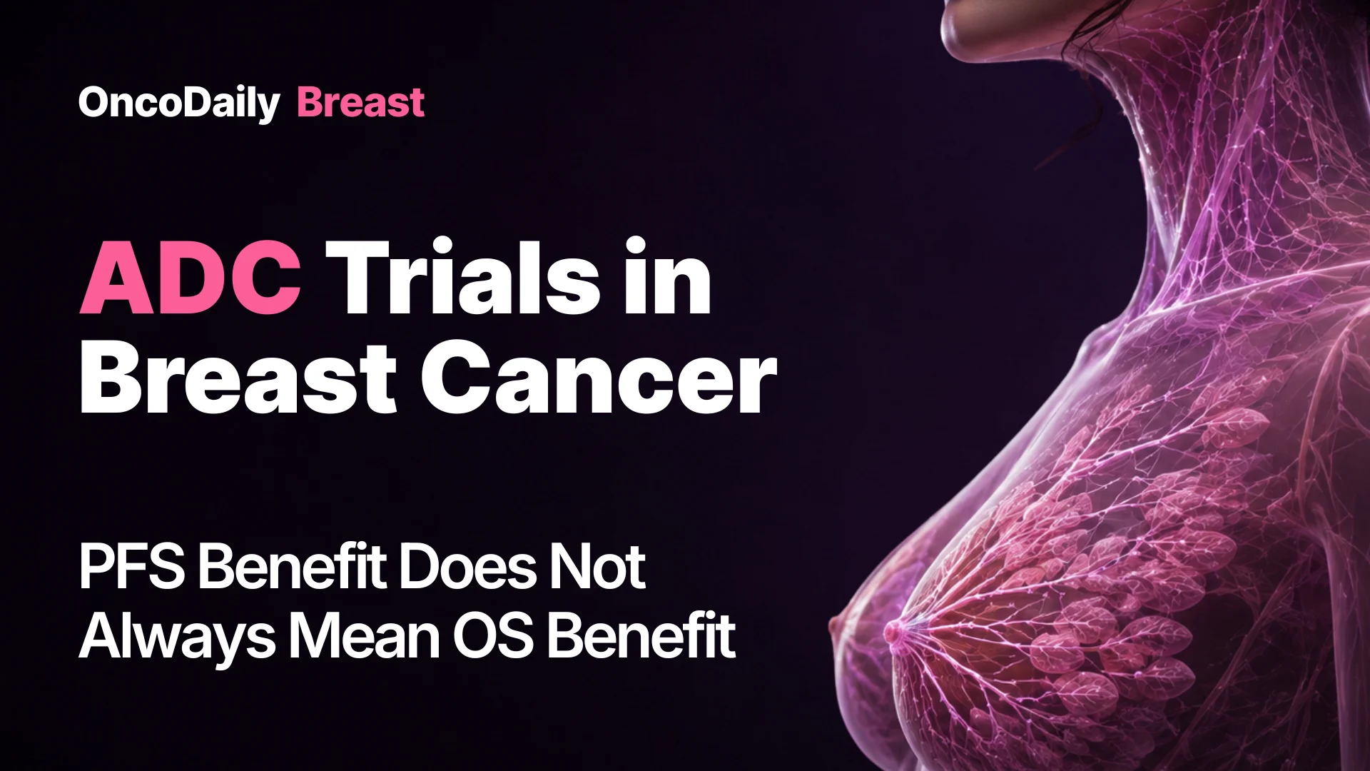 breast cancer